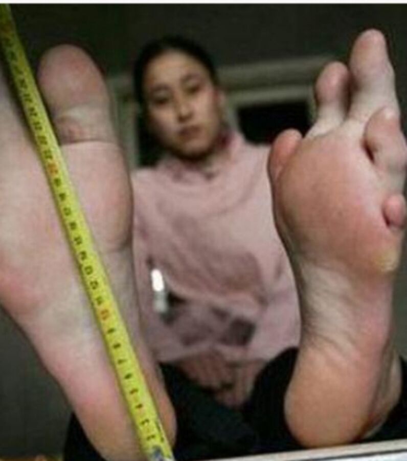 Photos The Worlds Ugliest Feet Ranked