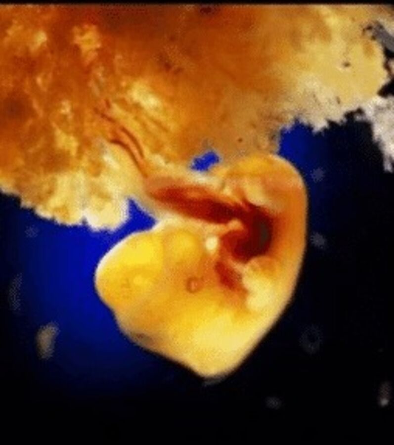 Photos Lévolution Du Foetus En 25 Photos Des Clichés Exceptionnels Du Début De La Vie 
