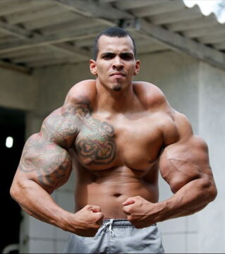 Romario Dos Santos Alves vient du Brésil. Il a fait plusieurs injections de synthol pour ressembler à Hulk.