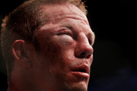 Marcus Davis après son combat contre Nate Diaz